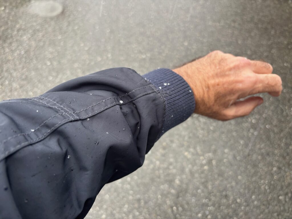 a hand with a hole in the sleeve